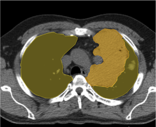 Advanced imaging AI