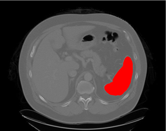 advanced imaging AI