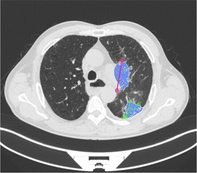 Medical data annotation company