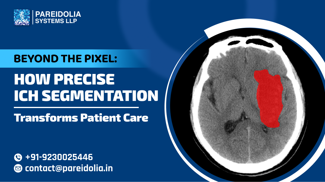 ICH segmentation in medical imaging