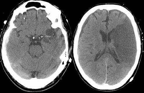 Ai medical diagnosis