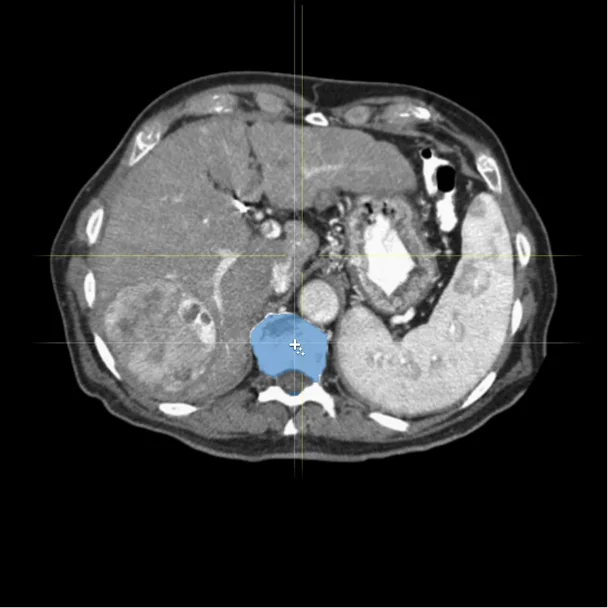 AI Data Annotation Services