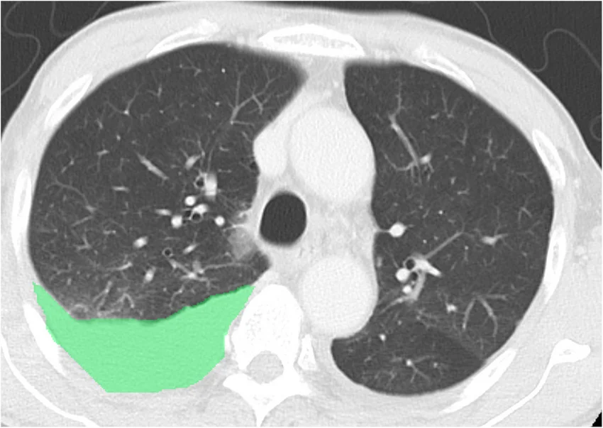AI Data Annotation Services