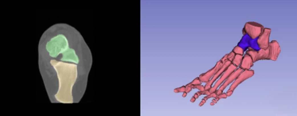 3d printed medical implants