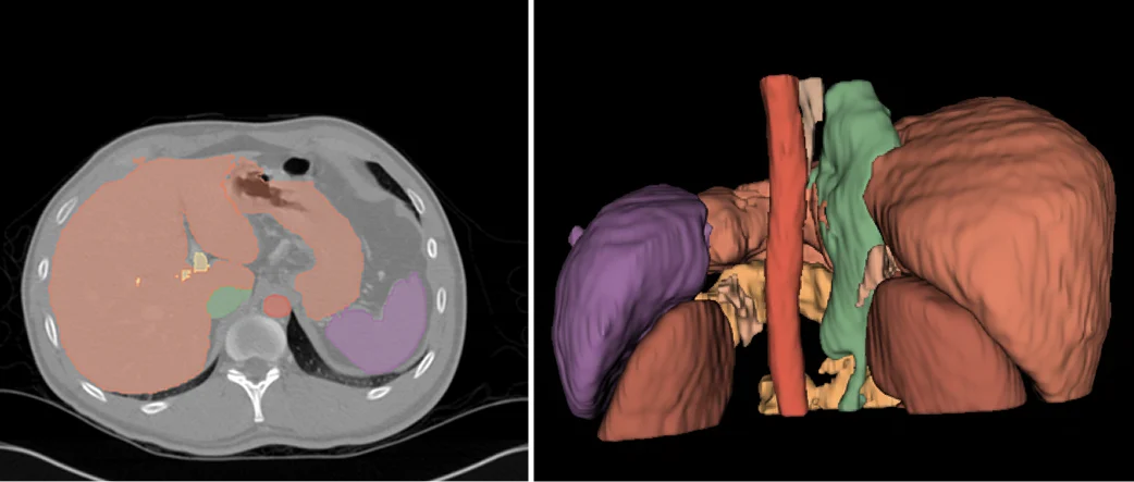 3d printed medical implants