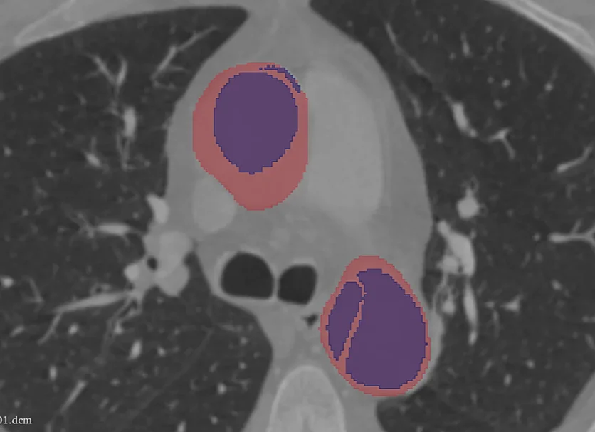 Medical image annotation accuracy