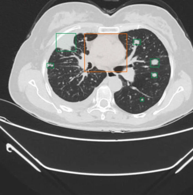 Medical image annotation accuracy