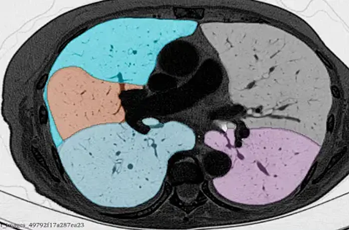 AI imaging endpoints