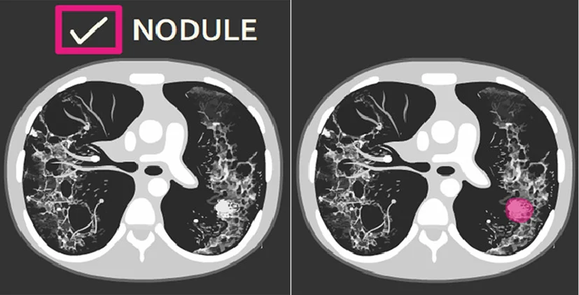 image classification vs segmentation