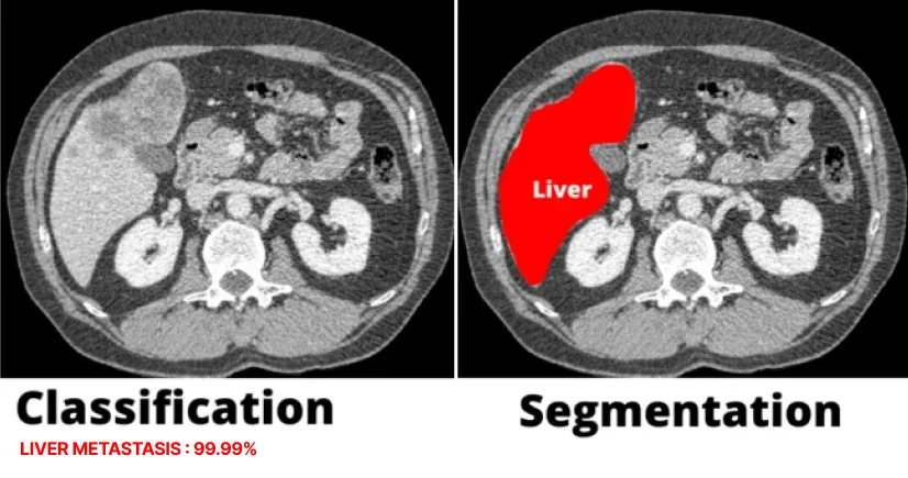 image classification vs segmentation