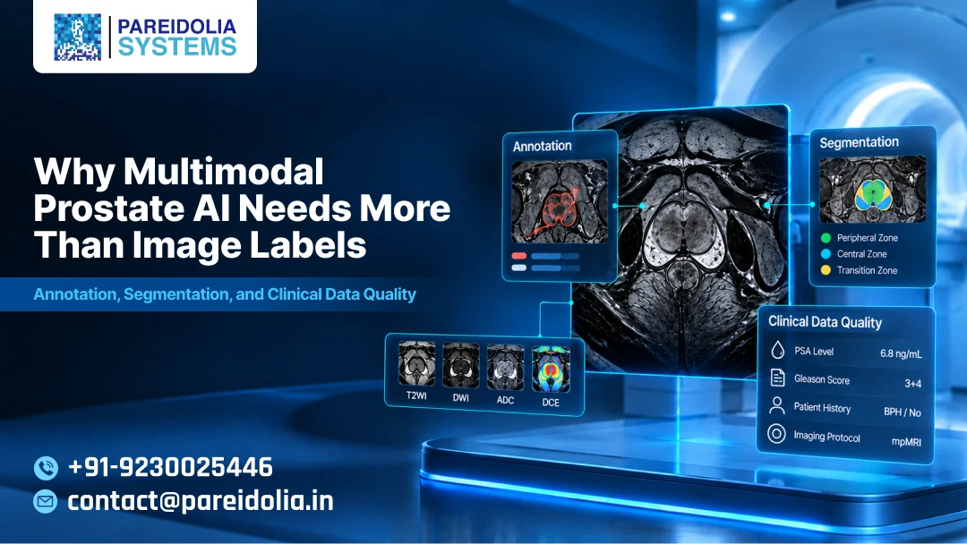 Why Multimodal Prostate AI Needs More Than Image Labels: Annotation, Segmentation, and Clinical Data Quality