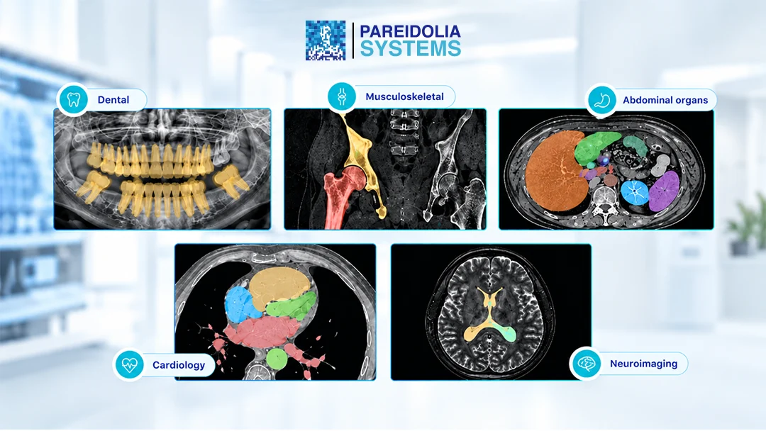 Medical Image Annotation Services: Use Cases Across Healthcare AI