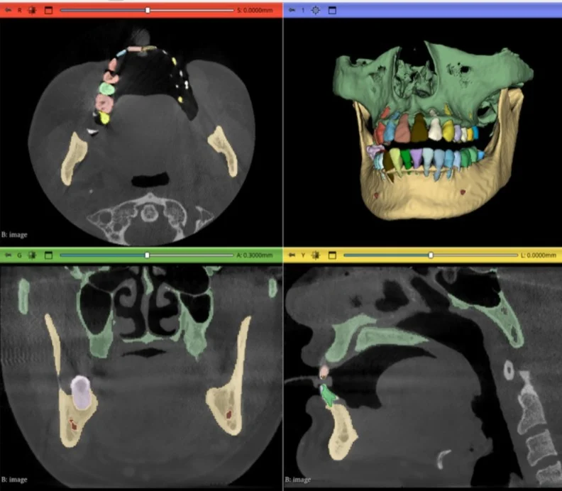 CBCT Annotation