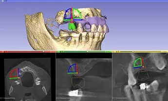 CBCT Annotation